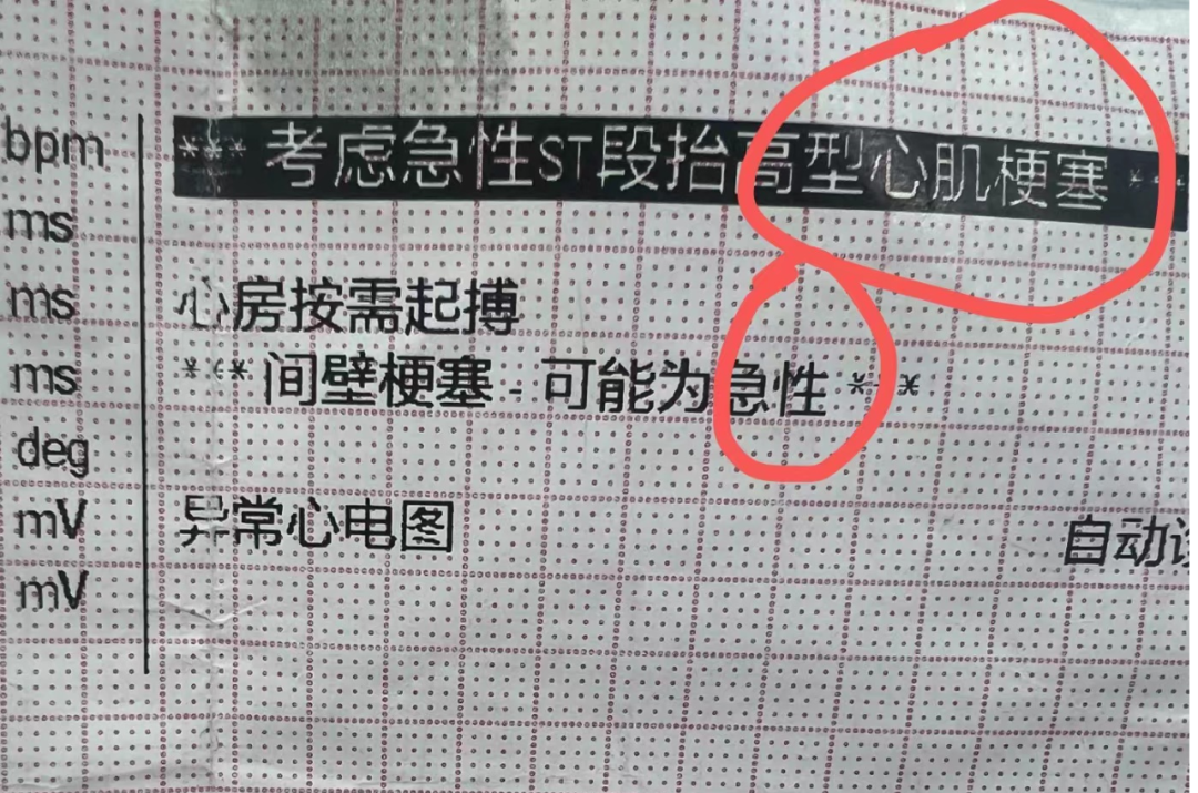 我被误诊“心梗”后